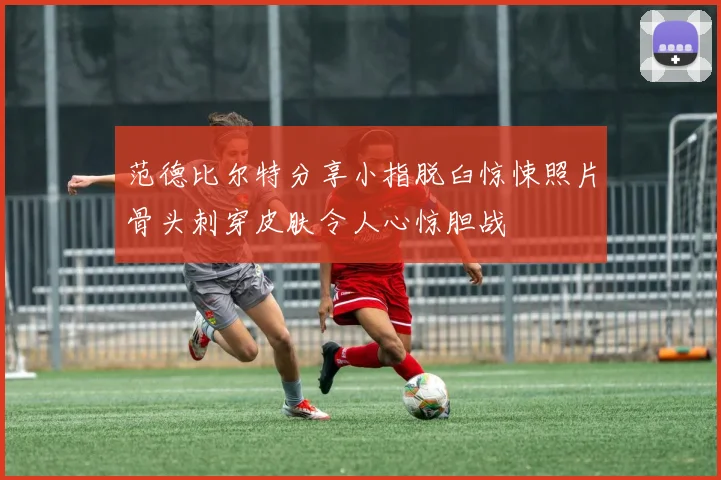 范德比尔特分享小指脱臼惊悚照片骨头刺穿皮肤令人心惊胆战